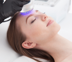 Acne Facial