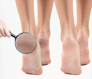 Foot Logix Pedicure