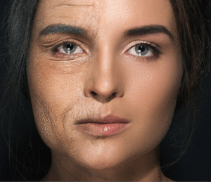 Muscle Banding Facial